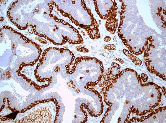 Inmunohistoquímica